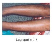 Treatment illustration